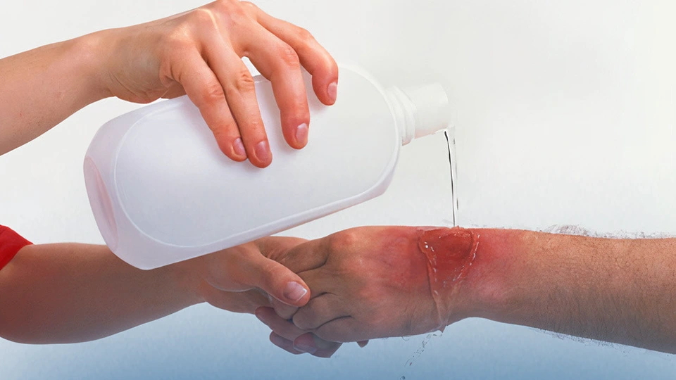 Common Injuries Faced by Instrument Technicians On-Site