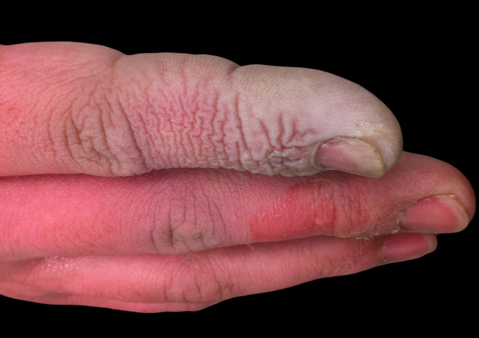 Real SIL, Real Safety: Flap-11C Plastic Magnetic Level Gauge Safely Measures Hydrofluoric Acid